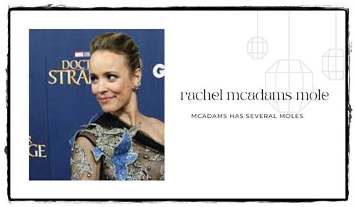 The Real Reason Rachel McAdams Hasn't Removed Her Iconic Mole